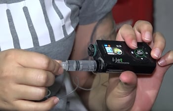 Hipertensión Arterial Pulmonar