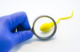 ¿Es reversible la vasectomía?