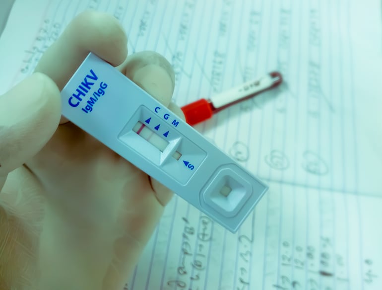 Test de chikunguña.