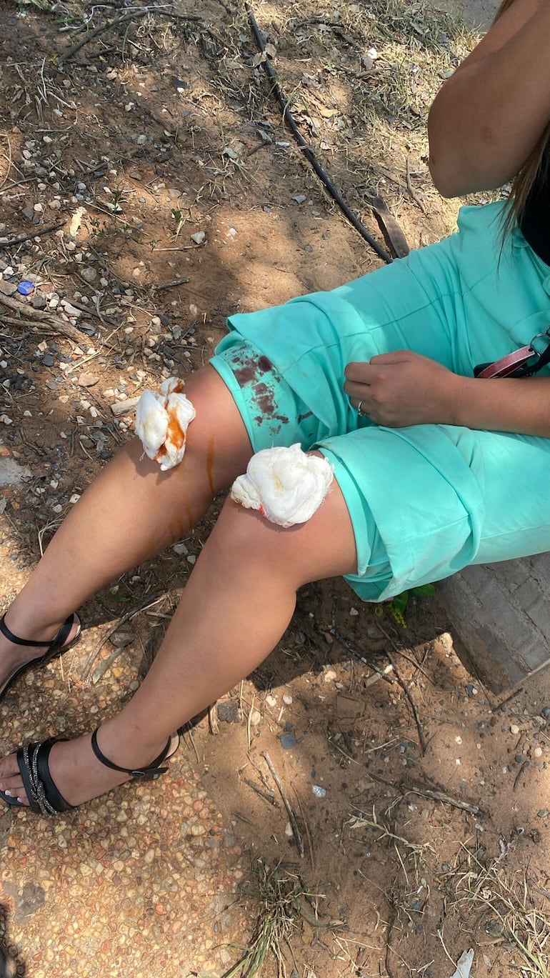 Periodista víctima de motochorros que fueron detenidos tras sufrir accidente de tránsito en su huida.