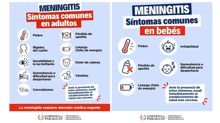 Ministerio de Salud informa sobre los síntomas a tener en cuenta por posible meningitis