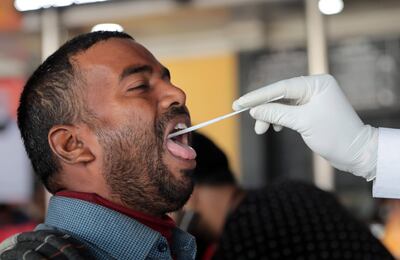 Una investigación científica apunta a la necesidad de una definición más clara de qué es el COVID persistente, y de estudios de control y seguimiento de casos mejor diseñados y en una escala de tiempo mayor.