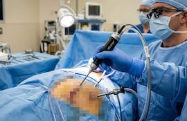 Primer plano de la mano de un cirujano manejando con el shaver durante una artroscopia.