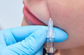 relleno de arrugas facial tratamiento estético