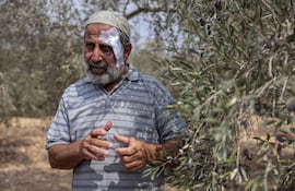 BURQA (CISJORDANIA), 15/10/2026.- Abdelatafi Bazari, de 59 años, camina con dificultad por su olivar en Burqa, al norte de Nablus, en Cisjordania ocupada. Con un moretón en el ojo izquierdo y una venda en la cabeza, relata cómo hace una semana colonos israelíes lo golpearon y abrieron fuego contra él y sus familiares mientras cosechaban aceitunas, en un ataque que en el que murió su primo. EFE/ Magda Gibelli