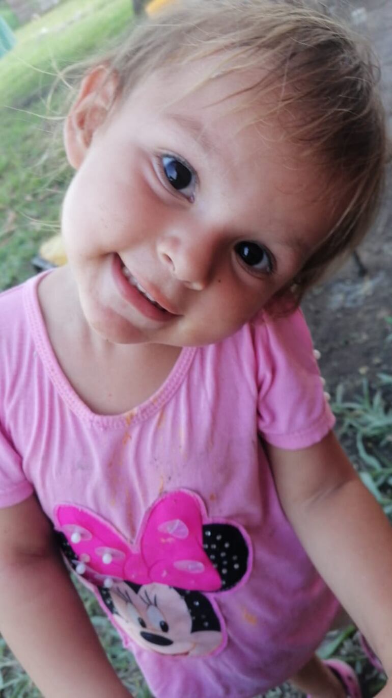 Paloma niña de tres años con enfermedad de Hirschsprung.