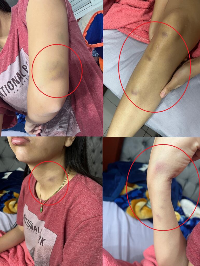 El rostro ensangrentado de la modelo Fiorella Zaracho, víctima de presunta agresión por parte de un hombre identificado como funcionario del Poder Judicial.