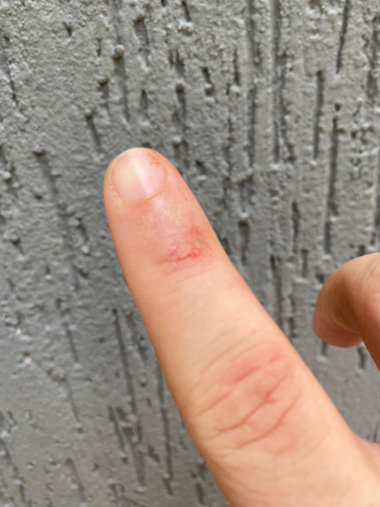 Ciclista cayó en un bache de la bicisenda de la calle Iturbe de Asunción, y quedó con heridas y la bicicleta dañada.