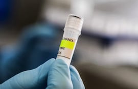 Esta fotografía, distribuida por el Ministerio de Salud de Argentina, muestra a un científico del Instituto Malbrán sosteniendo un recipiente utilizado para diagnosticar el hantavirus andino, que contiene ARN del virus como parte del proceso de detección, en Buenos Aires el 6 de mayo de 2026.