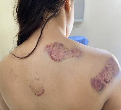 La mujer victima de varias lesiones en su cuerpo.