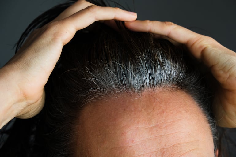 Concepto de canas, pelo gris, dejar de teñirse.
