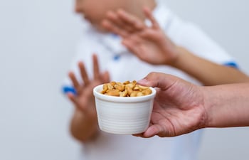 Niño con alergia al maní.