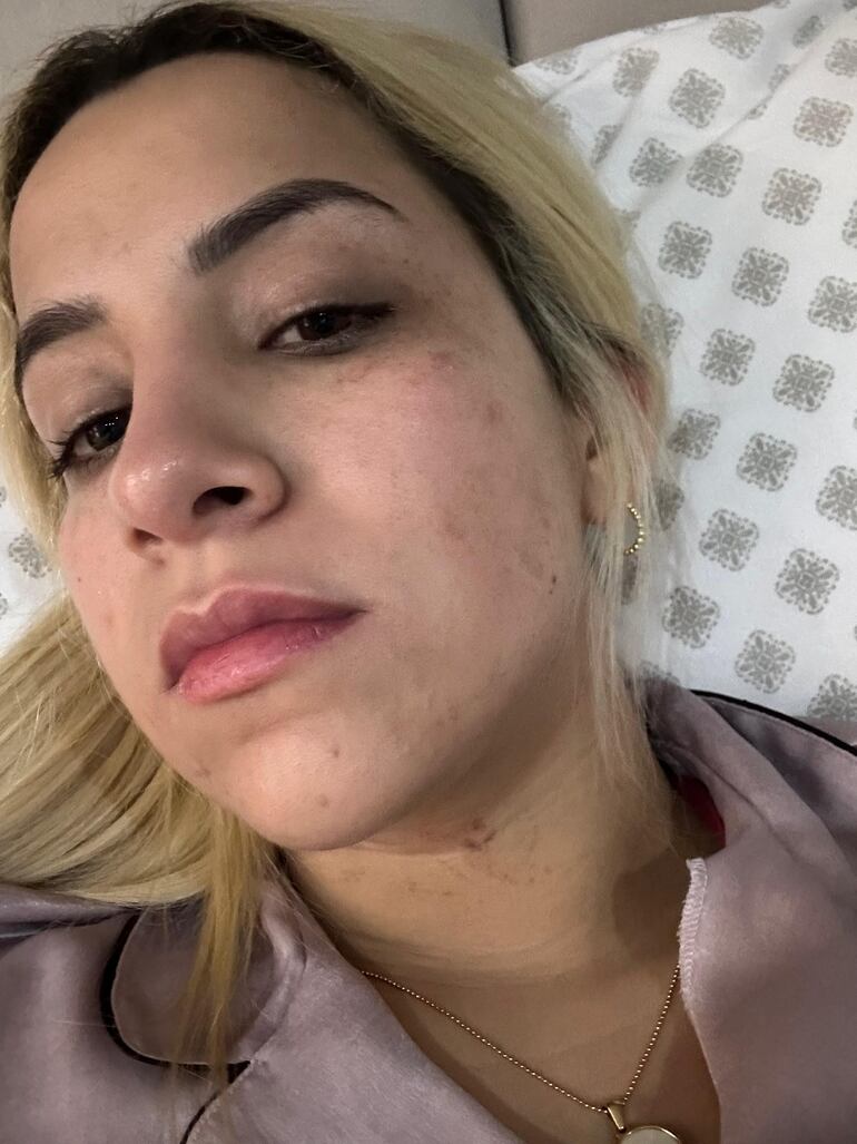 Lorena Segovia, víctima de violencia por parte de Cristian Vera, imputado por la Fiscalía.