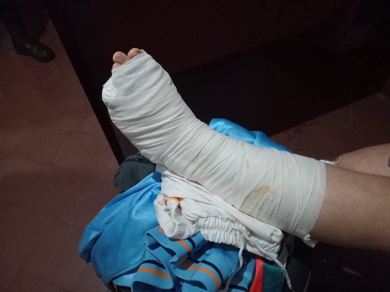 Fiorella Figueredo, joven herida de bala durante un violento asalto en Lambaré
