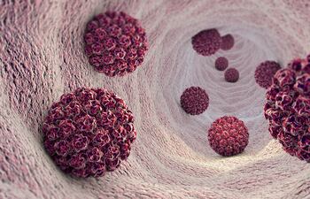 Infección por el virus del papiloma humano (VPH)