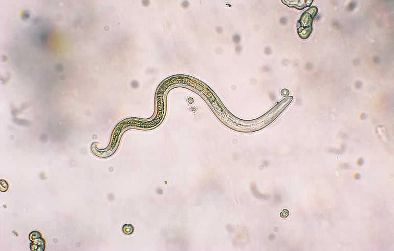 Toxocara canis, imagen ilustrativa.