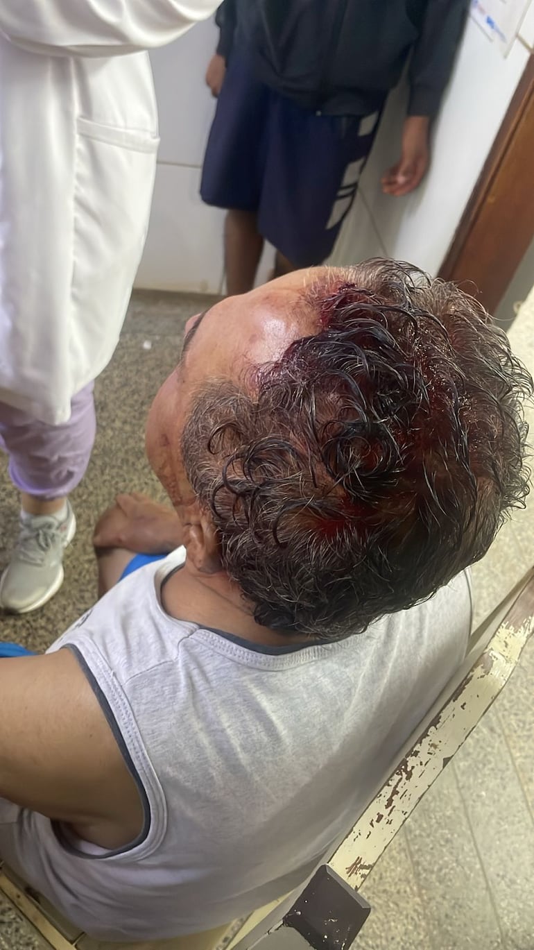 Mariano Pessoa, recibió atención médica en el Hospital Regional de Pedro Juan Caballero.