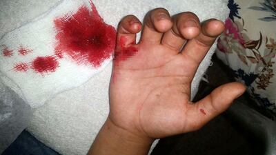 /pf/resources/images/abc-placeholder.png?d=2395