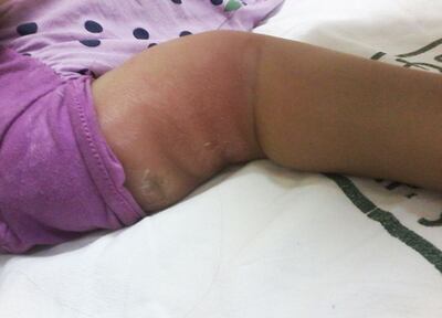 /pf/resources/images/abc-placeholder.png?d=2395