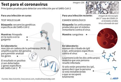 Test serológico para dejar  confinamiento