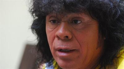 /pf/resources/images/abc-placeholder.png?d=2394