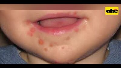 Imagen sin descripción