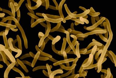 /pf/resources/images/abc-placeholder.png?d=2421