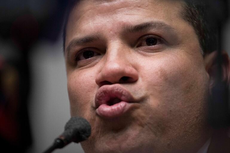 El legislador opositor venezolano Luis Parra.