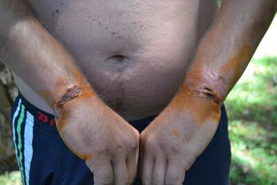 /pf/resources/images/abc-placeholder.png?d=2395