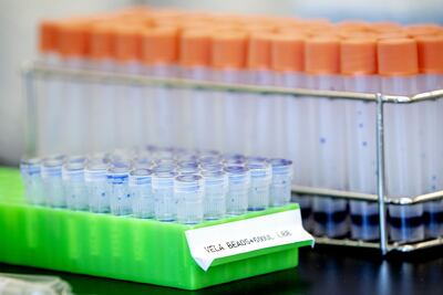 Muestras de pruebas para detectar coronavirus.