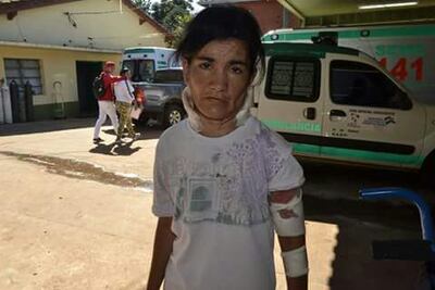 /pf/resources/images/abc-placeholder.png?d=2395