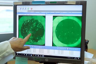 La foto muestra una célula infectada con coronavirus covid-19 en un laboratorio de España. (EFE)