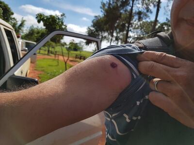 /pf/resources/images/abc-placeholder.png?d=2429