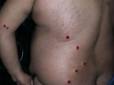 /pf/resources/images/abc-placeholder.png?d=2394