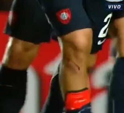 /pf/resources/images/abc-placeholder.png?d=2395