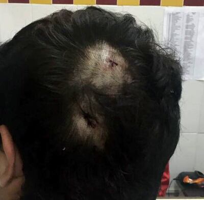 /pf/resources/images/abc-placeholder.png?d=2393