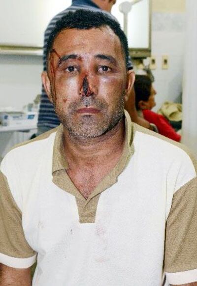 /pf/resources/images/abc-placeholder.png?d=2393