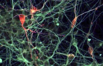 las-neuronas-normalmente-no-se-regeneran-tras-diversas-lesiones-de-la-medula-espinal-archivo-200636000000-1119051.jpg