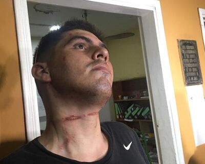 /pf/resources/images/abc-placeholder.png?d=2394