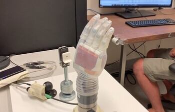 El brazo "Luke" está hecho de motores de metal y de una "piel" de silicona transparente y se alimenta por una batería externa.