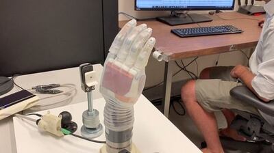 El brazo "Luke" está hecho de motores de metal y de una "piel" de silicona transparente y se alimenta por una batería externa.