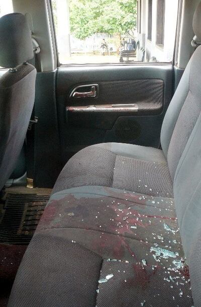 /pf/resources/images/abc-placeholder.png?d=2420