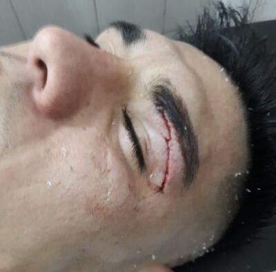 /pf/resources/images/abc-placeholder.png?d=2419