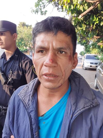 Adilio Arturo Olmedo Benítez (35).