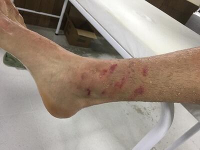 Gustavo Gómez, lesión.