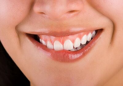 /pf/resources/images/abc-placeholder.png?d=2393