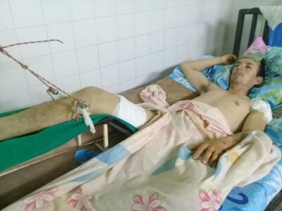 /pf/resources/images/abc-placeholder.png?d=2395