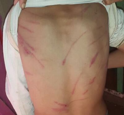 /pf/resources/images/abc-placeholder.png?d=2393