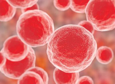 FDA estadounidense halla indicios de vínculos entre el cáncer de mama y un tipo de implante mamario. (archivo)