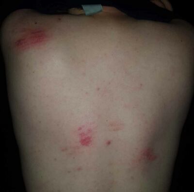 /pf/resources/images/abc-placeholder.png?d=2393